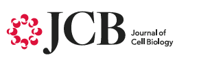 Cleanascite™ Cited In Study of Lipid Biology in Endoplasmic Reticulum Stress